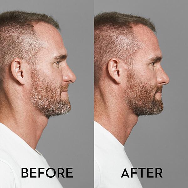 True Sons - Before and After - Men's Hair Dye Greying/Greys | SWAGGER Magazine