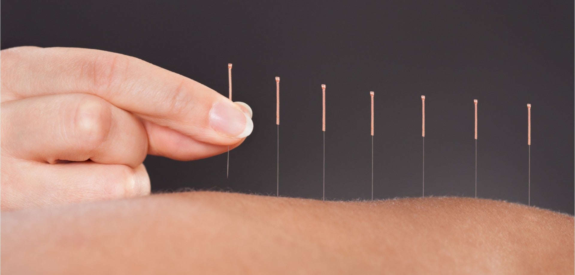 Acupuncture And Penis Enlargement picture